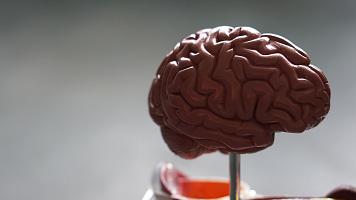Image representing Psychology (Conversion)